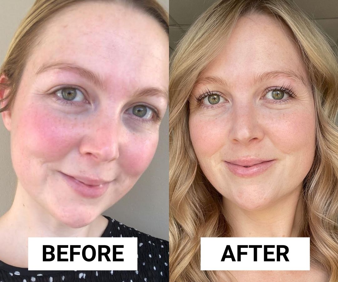 Cetaphil Redness Relief Night Cream Before & After