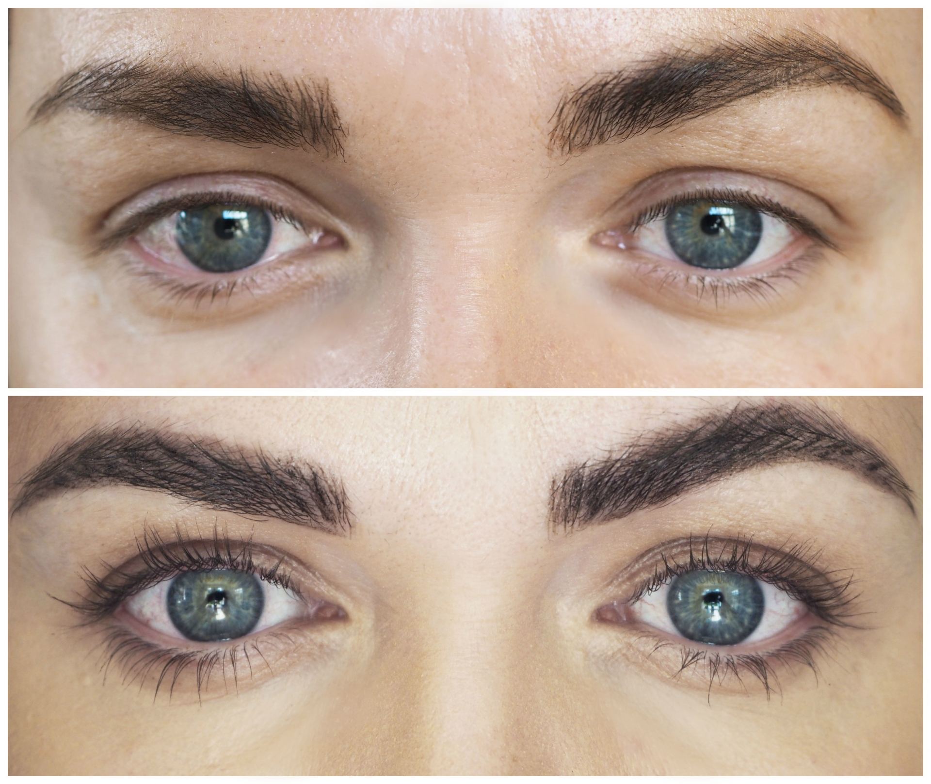 Daytox Eye Wonder Serum Before and After Pictures
