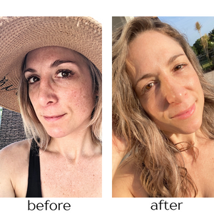 Envy RX Face Serum Before and After Pictures