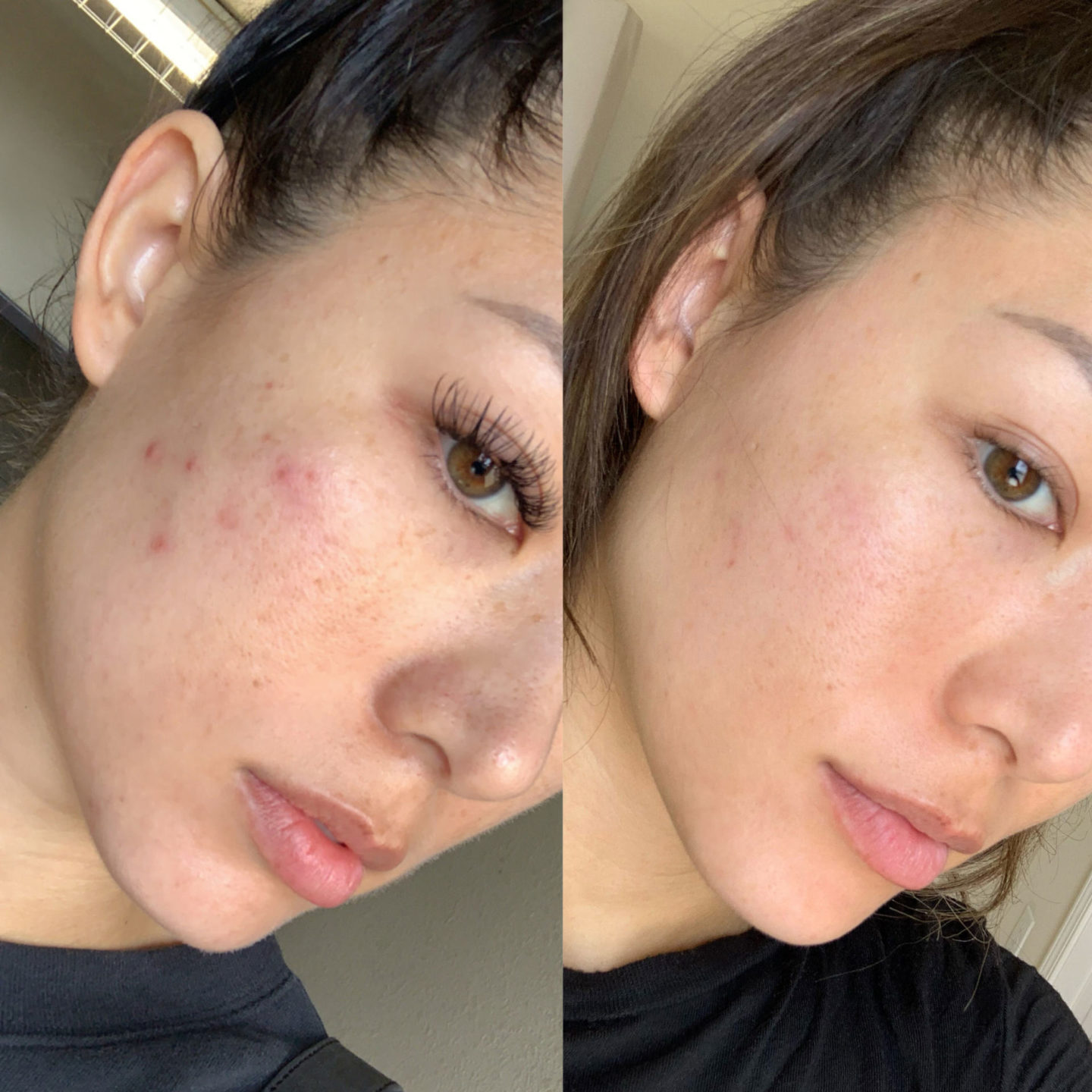 Dr.Irena Eris Algorithm 40+ Serum Before and After Pictures