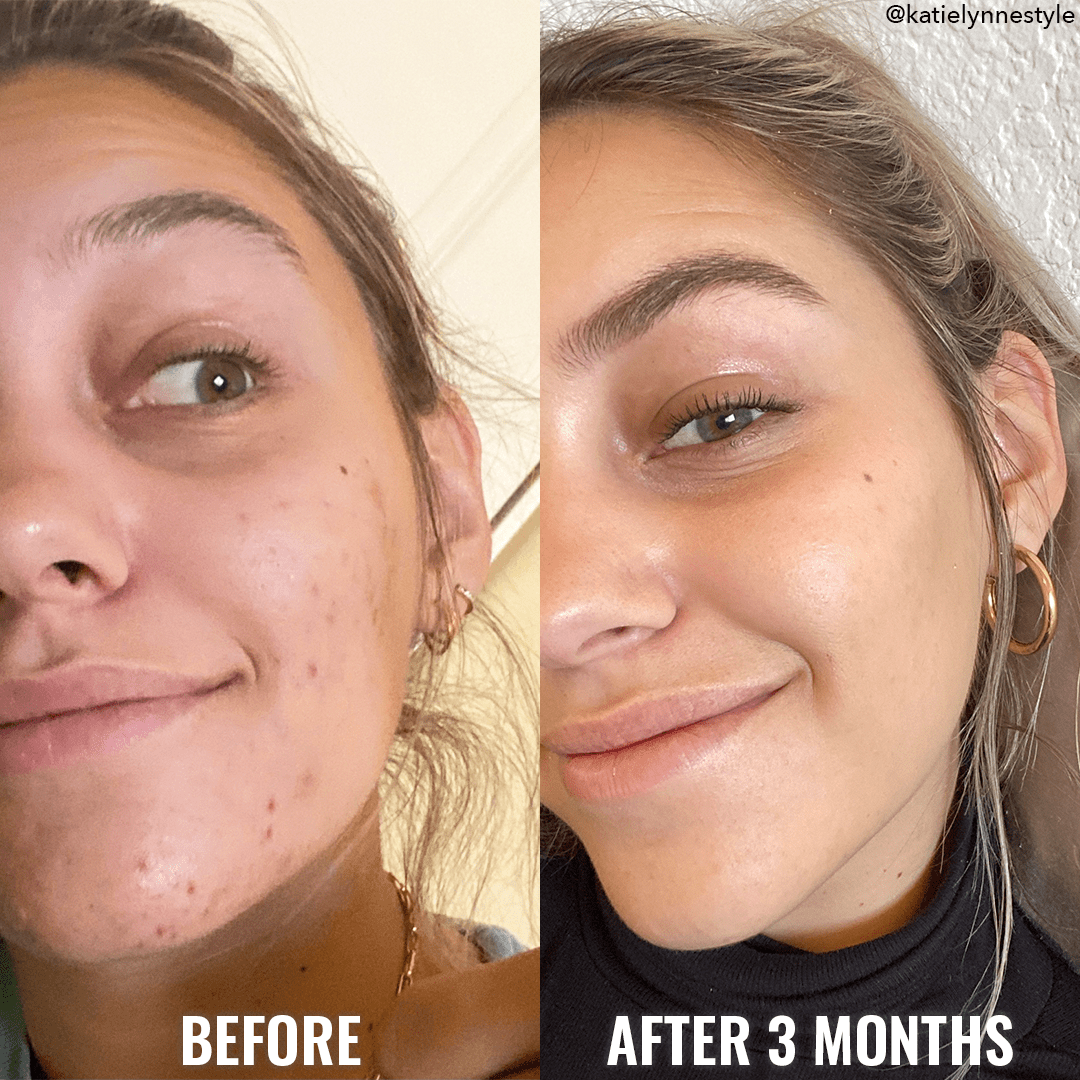 Fresh Toner Rose Before and After