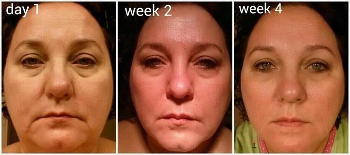 Hersolution Sculpt Scrub Before and After Image