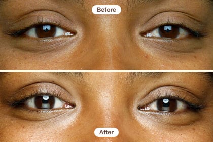 Juice Beauty Smoothing Eye Concentrate Before and After Images Pictures