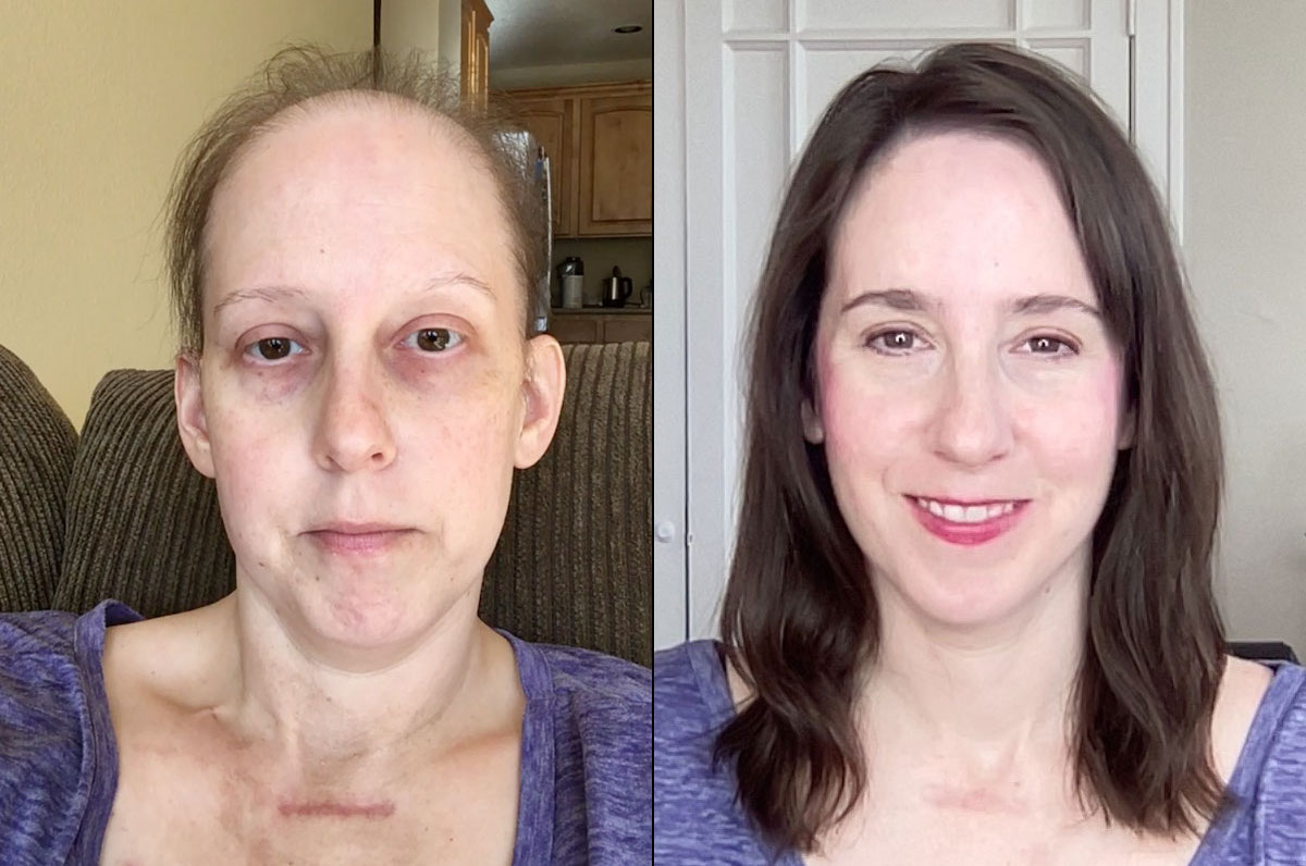 Neutrogena Healthy Skin Eye Cream Before and After Pictures