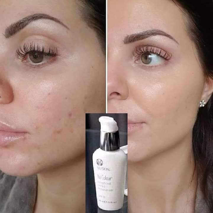 Nu Skin Advanced Tinted Moisturizer  Before and After Pictures