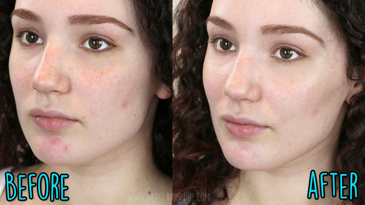 Omorovicza Miracle Facial Oil