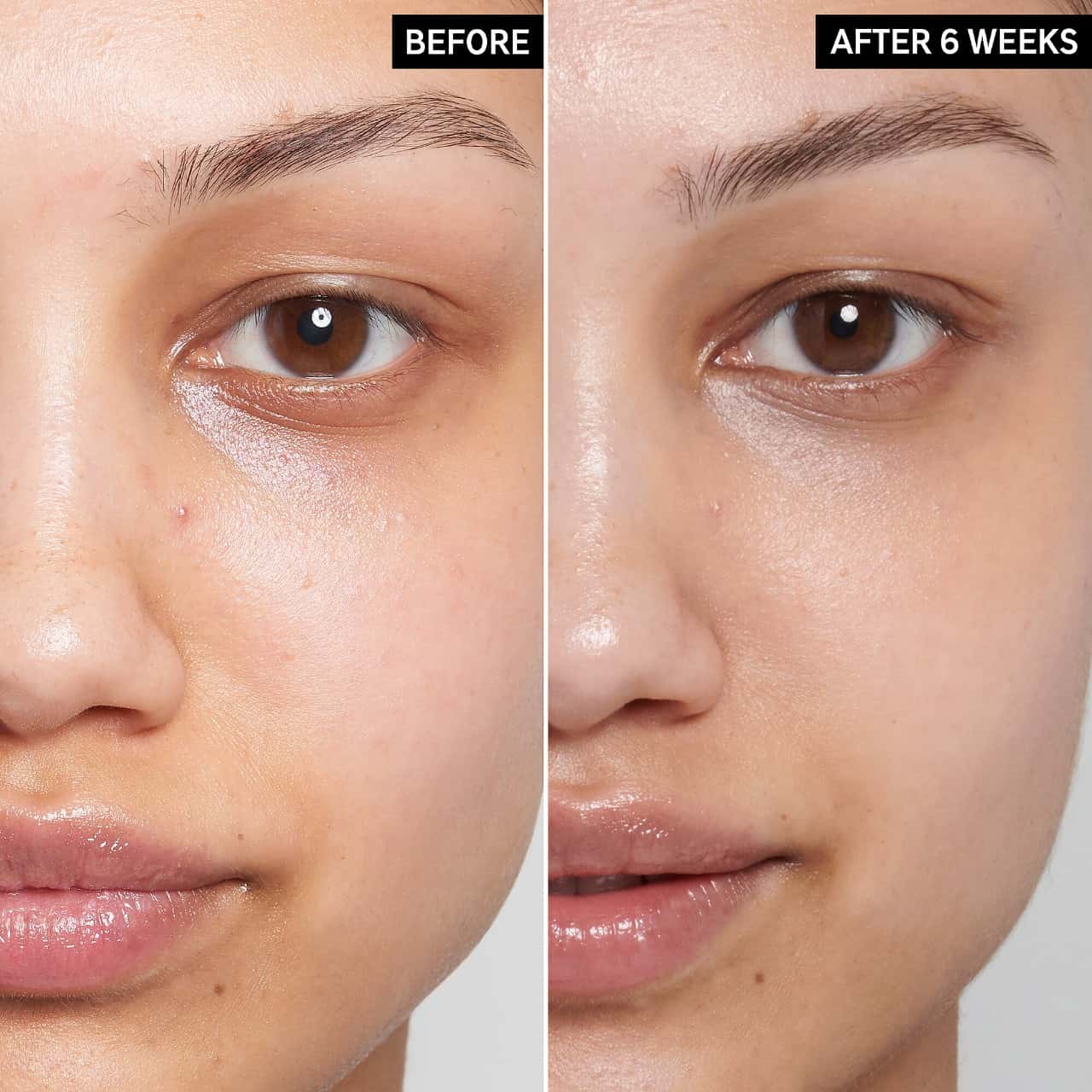 The Ordinary Before and After Image