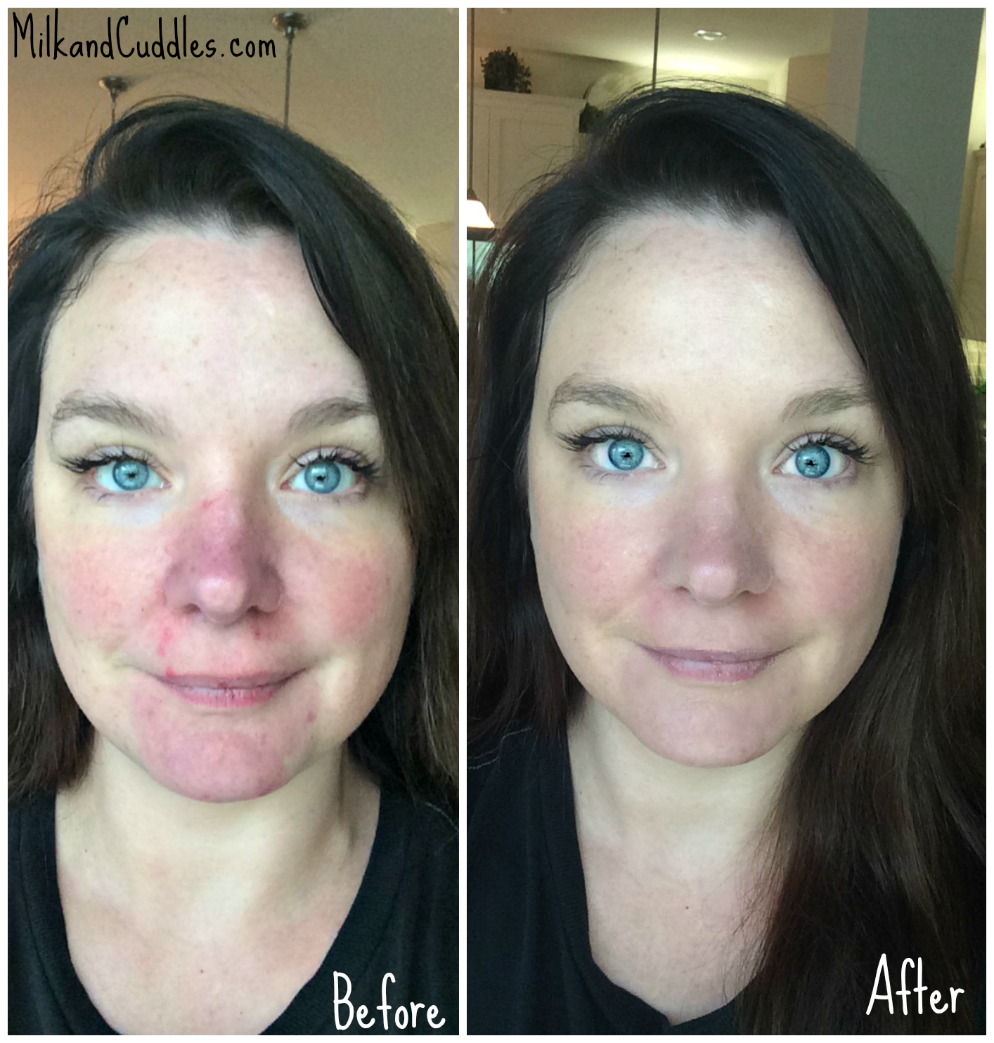 Revision Intellishade SPF 45 Moisturizer before and After Pictures 
