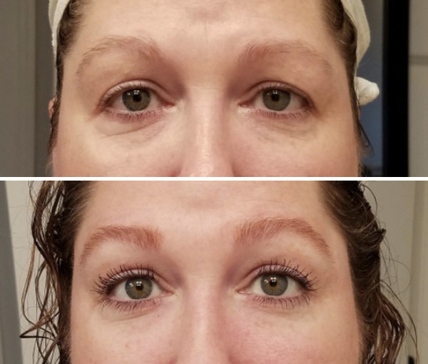 Roc Multi-Correxion 5-In-1 Eye Cream before and after Pictures