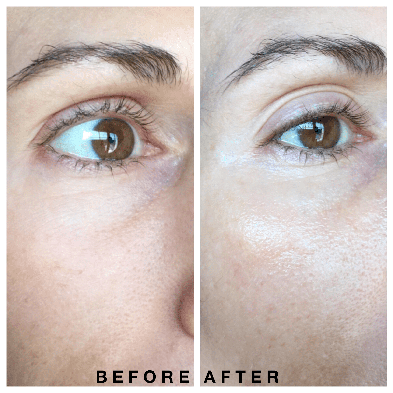 Shiseido Benefiance Wrinkleresist24 Eye Cream Before and After Pictures