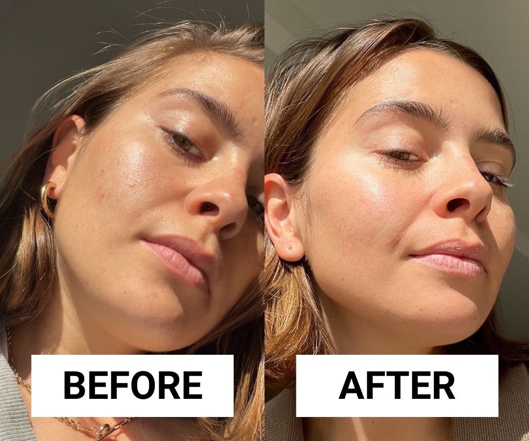 Skinceuticals Phyto Plus Before and After Image