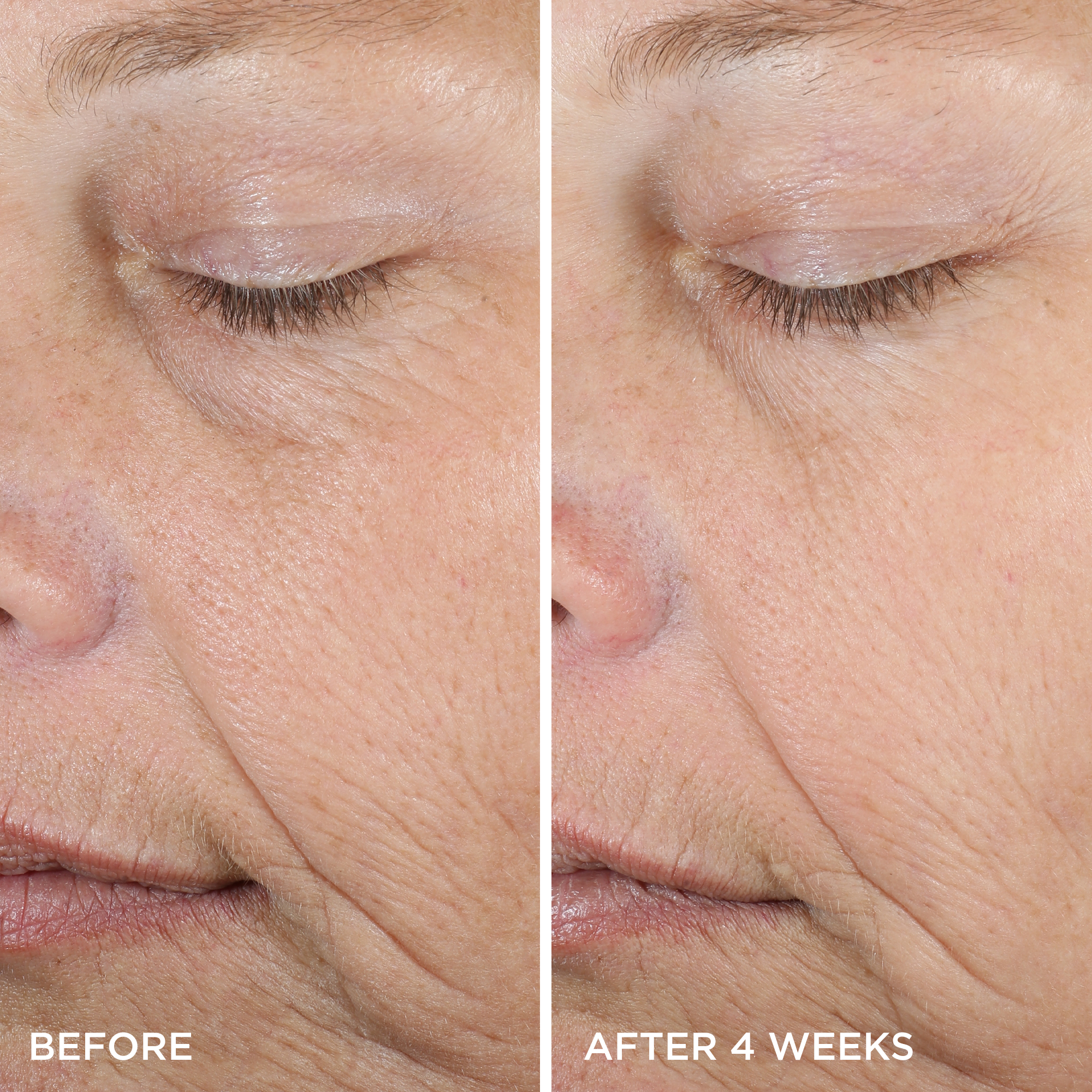 Tatcha Luminous Deep Hydrating Firming Eye Serum Before and After Pictures