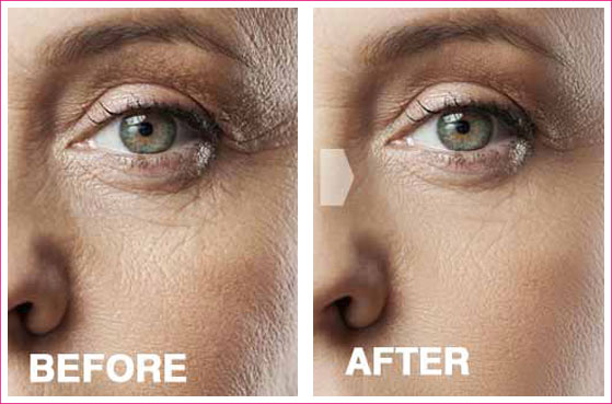 tru alchemy eye elixir before and after images