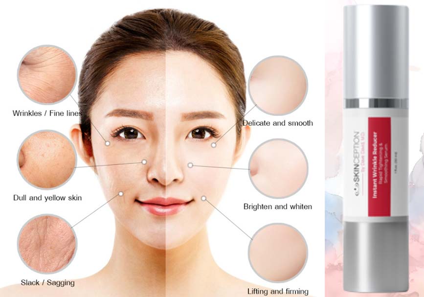 Instant Wrinkle Reducer Review