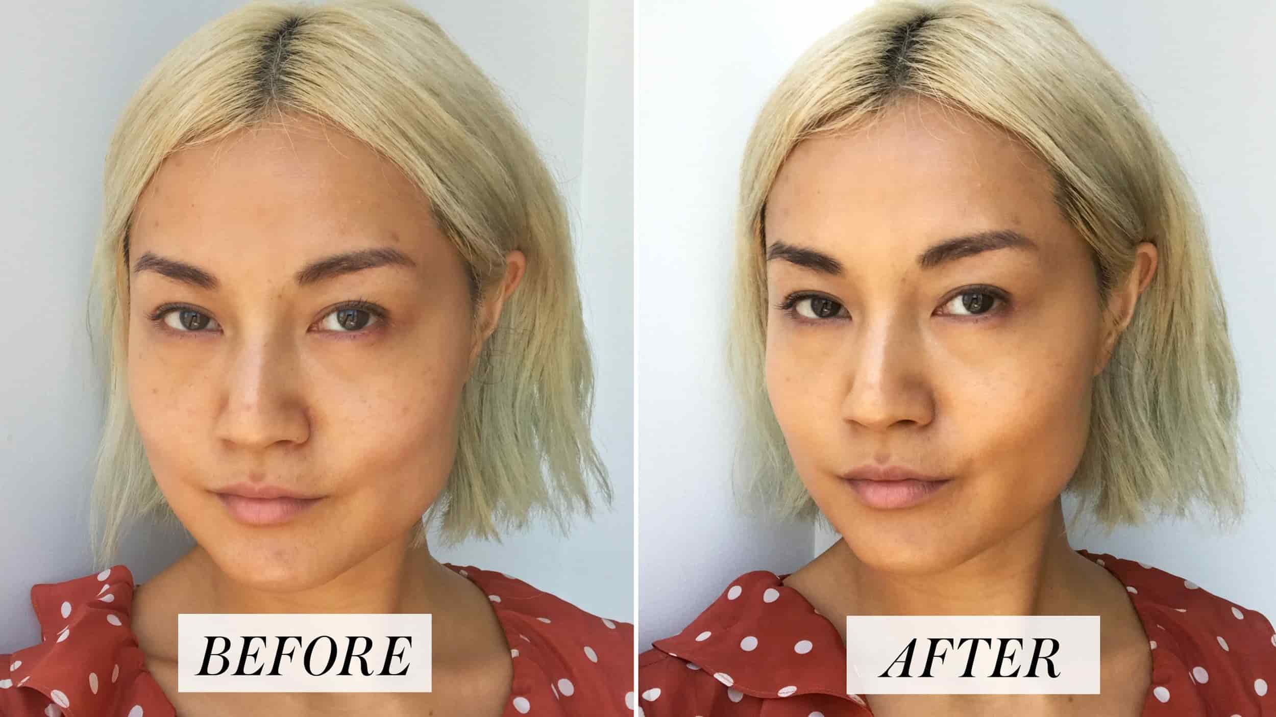 Neutrogena Before and After Pictures