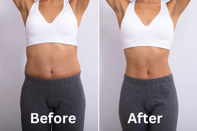 Nushape Lipo Wrap before and after