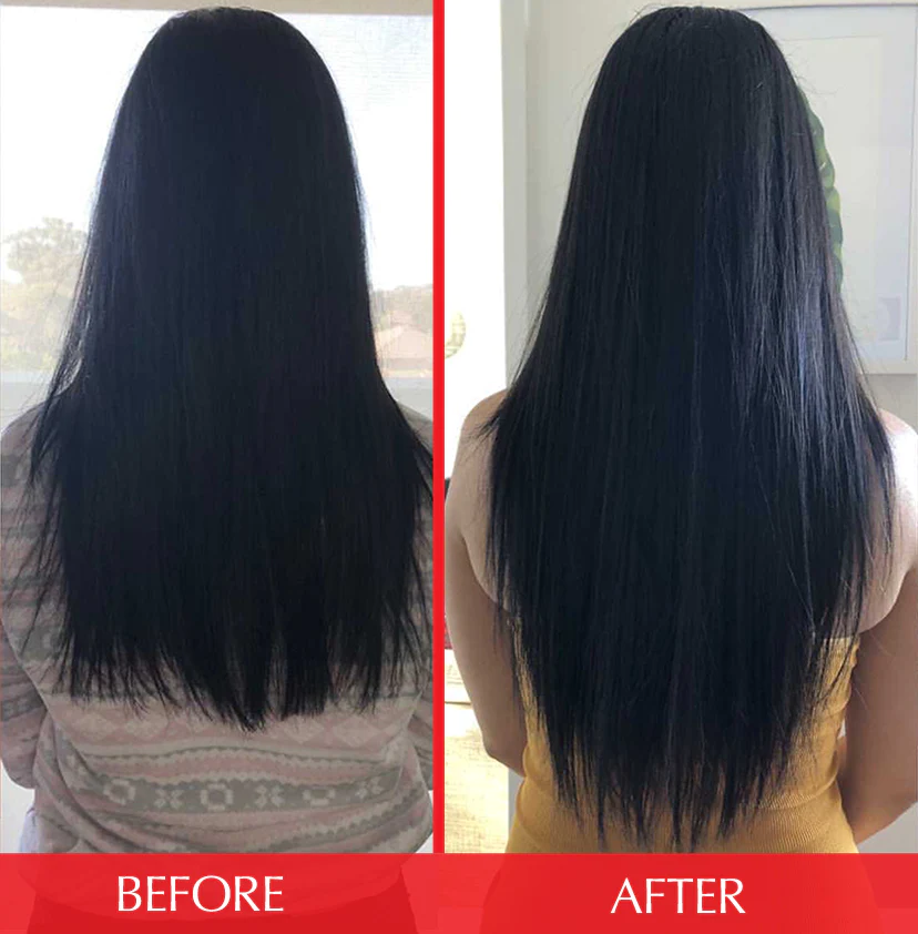  Nuzena Biotin Pure+  before and after