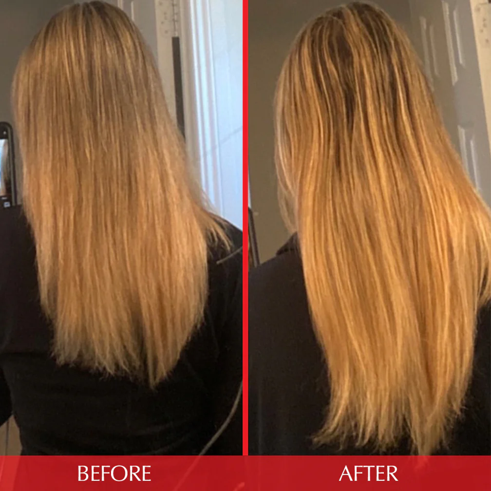  Nuzena Hair Growth Support+  before and after