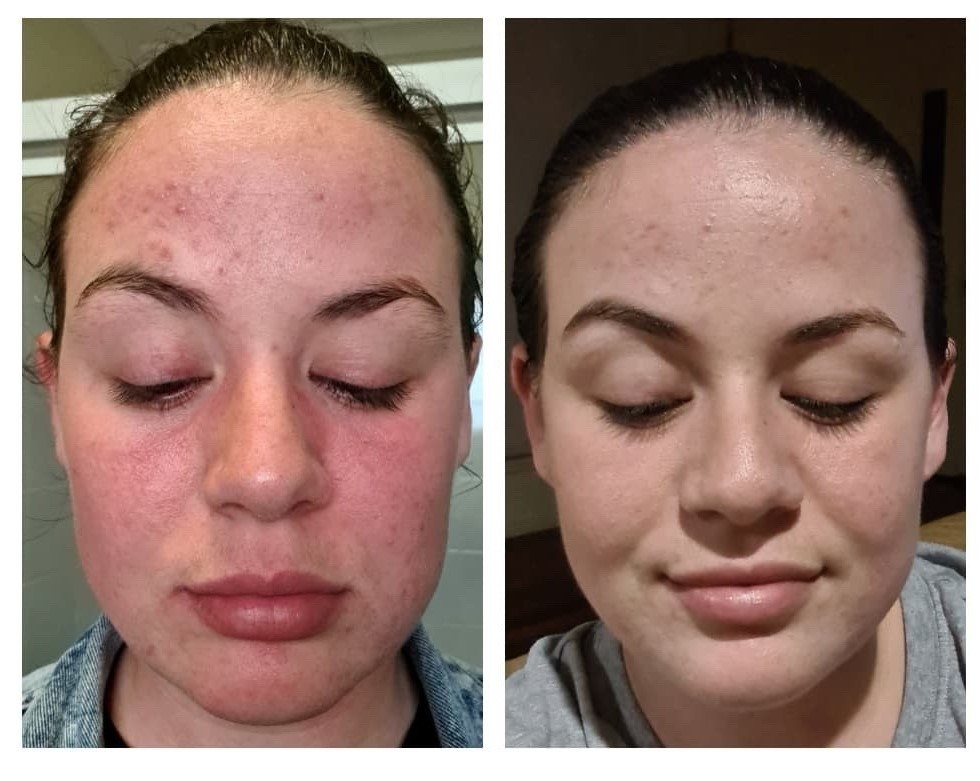 ole henriksen wonderfeel double cleanser before and after