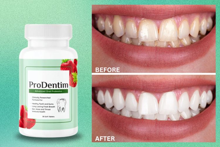  prodentim oral probiotics before after