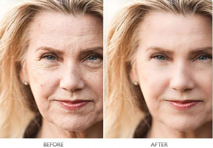 Skinceuticals Age Interrupter Before and After Image