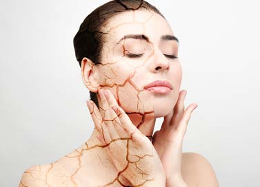 What Is Xerosis Cutis Or Abnormally Dry Skin? Know All About It