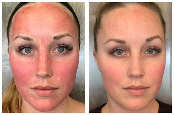 XYZ Smart Collagen Before and After Images